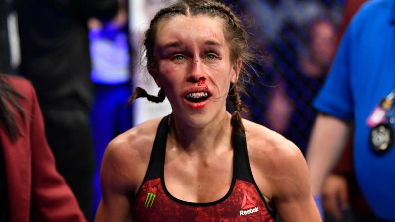 POGLED: Joanna Jedrzejczyk pretrpjela groteskni hematom u ratu s Weili Zhang na UFC-u 248 - CBSSports.com